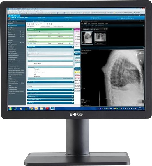 BARCO Eonis 21 MDRC-2321