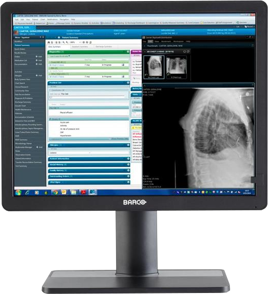 BARCO Eonis 21 MDRC-2321