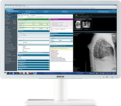 BARCO Eonis 24” MDRC-2324