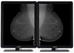 BARCO Nio 5MP MDNG-5221