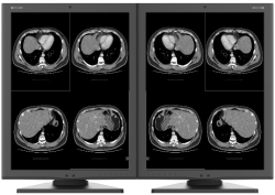Monochromatyczny monitor JUSHA M270G 2 MP