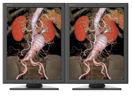 rentgen dwumonitorowe 2