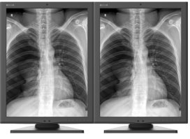 rentgen dwumonitorowe 2