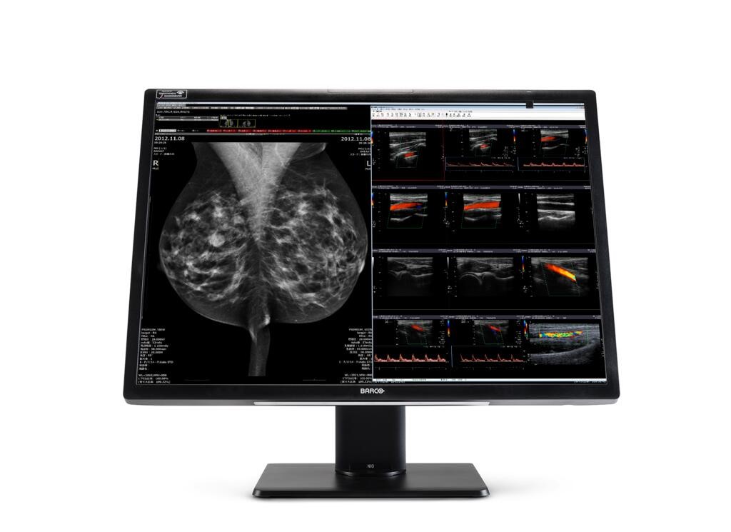mammografia jednomonitorowe 2