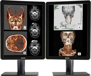 rentgen dwumonitorowe 1