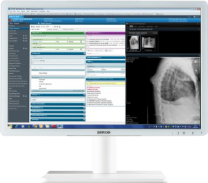 BARCO Eonis 24” MDRC-2324 (konfiguracje sugerowane)